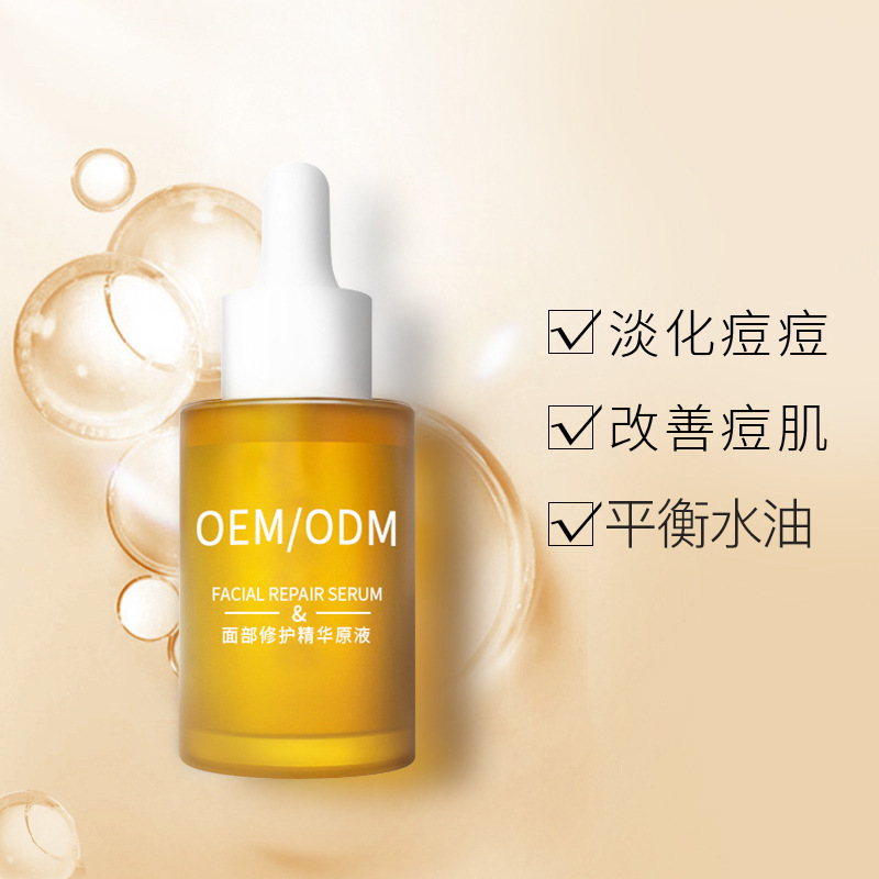 油尖旺区_祛痘精华原液OEM